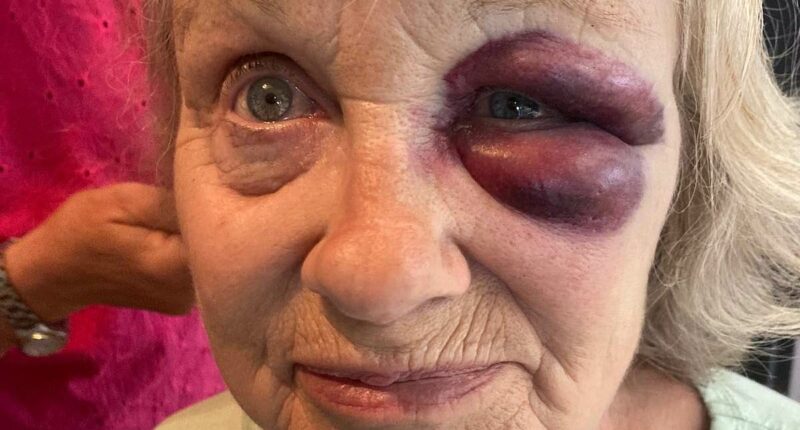 Pensioner, 68, 'lucky' to be alive after accident before dad's funeral