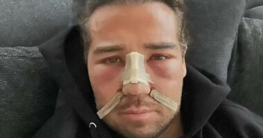 TOWIE's James Lock, 38, spent £100K on cosmetic surgery