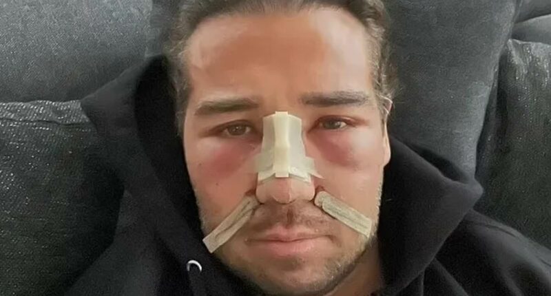 TOWIE's James Lock, 38, spent £100K on cosmetic surgery