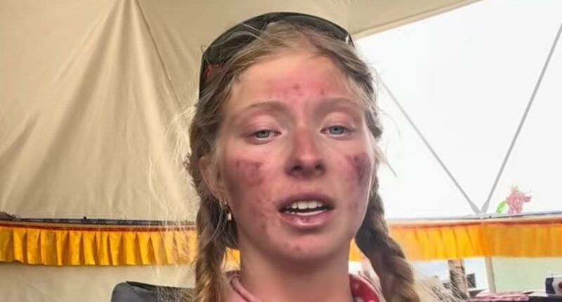 Teen reveals what happened to her body while climbing Mount Everest