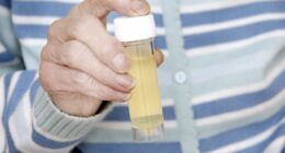 The 1 simple test that could reveal dementia risk decades before symptoms appear