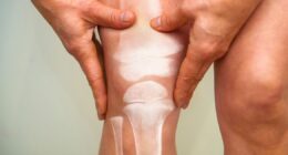 The 8 things that could be making your bones brittle – and how to avoid them