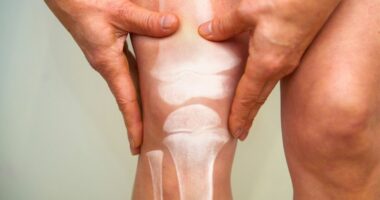 The 8 things that could be making your bones brittle – and how to avoid them