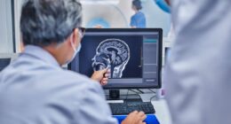 The daily habit that could 'increase risk of deadly stroke' if skipped — not exercise