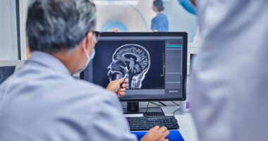 The daily habit that could 'increase risk of deadly stroke' if skipped — not exercise