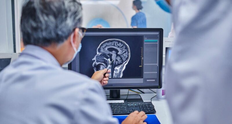 The daily habit that could 'increase risk of deadly stroke' if skipped — not exercise