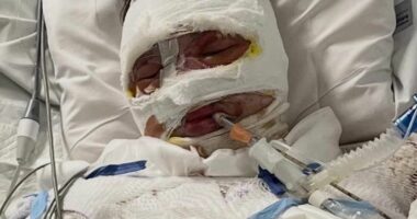 Update after teenager was allegedly doused in petrol and set alight