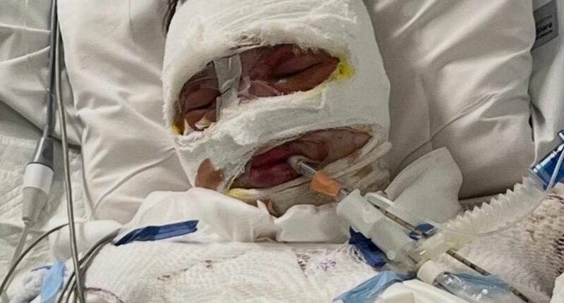 Update after teenager was allegedly doused in petrol and set alight