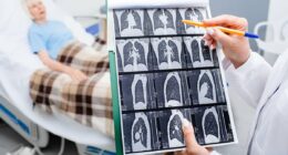 'I was in incredible pain... the doctor said it was just discomfort from breastfeeding': Gini was a non-smoker whose bad shoulder left her in agony. Eventually, she discovered it was lung cancer. Now, our expert reveals the hidden signs of the disease