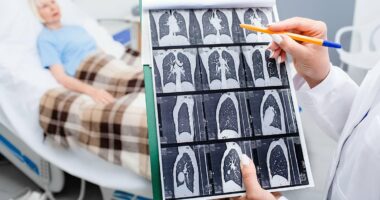 'I was in incredible pain... the doctor said it was just discomfort from breastfeeding': Gini was a non-smoker whose bad shoulder left her in agony. Eventually, she discovered it was lung cancer. Now, our expert reveals the hidden signs of the disease