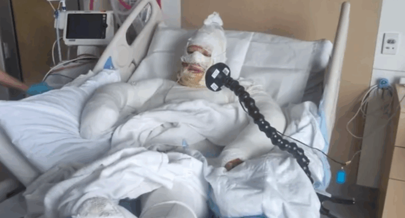 'Like being fried': WA mum suffers serious burns in firebombing