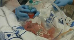 'My baby came 13 weeks early - I was stunned when nurses put him in a Tesco sandwich bag'