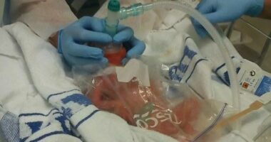 'My baby came 13 weeks early - I was stunned when nurses put him in a Tesco sandwich bag'