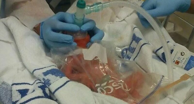 'My baby came 13 weeks early - I was stunned when nurses put him in a Tesco sandwich bag'