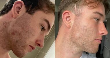 'My nurse nan sent me a package for my spotty skin and now I run my own business'