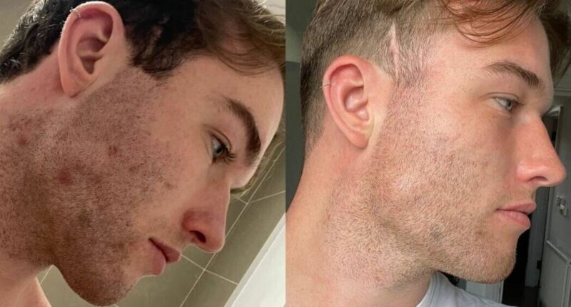 'My nurse nan sent me a package for my spotty skin and now I run my own business'