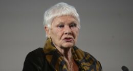 AMD explained as Judi Dench 'can't leave house alone' because of condition