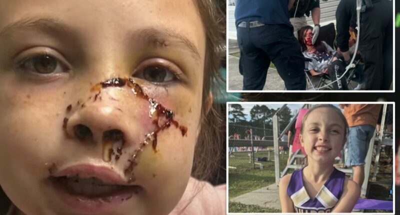 Alabama girl, 9, mauled by dog that 'grabbed' her face, leaving brutal injuries