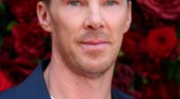 Benedict Cumberbatch has revealed he secretly underwent surgery following a brutal surfing injury (pictured in August)