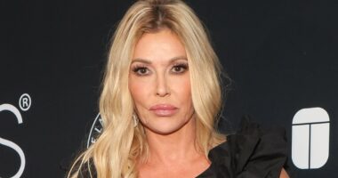 Brandi Glanville gives update after life was ruined by facial parasite