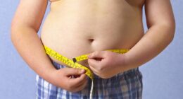 Britain's child obesity crisis laid bare: One in three kids in parts of the UK now overweight or obese BEFORE they start primary school - is YOUR area one of the hotspots?