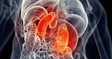 Chronic kidney disease has more than DOUBLED since 1990 to 800 million, experts discover: 'It's a growing global health crisis'