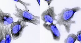 Neuroblastoma is a deadly cancer that can affect children as young as two-years-old. A new study by the Garvan Institute may have found a drug that can help cure it.