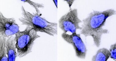 Neuroblastoma is a deadly cancer that can affect children as young as two-years-old. A new study by the Garvan Institute may have found a drug that can help cure it.