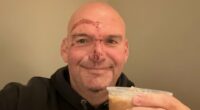Fetterman posts selfie of scarred face after heart problem causes fall