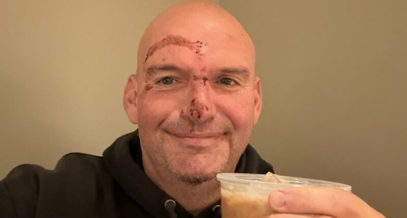 Fetterman posts selfie of scarred face after heart problem causes fall