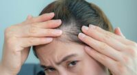 Hair loss expert names the trendy hairstyle causing women to go bald: 'It causes repeated stress and breakage'
