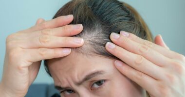 Hair loss expert names the trendy hairstyle causing women to go bald: 'It causes repeated stress and breakage'
