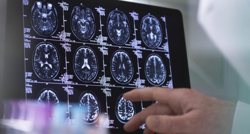 Heart test can show dementia risk up to 25 years before diagnosis