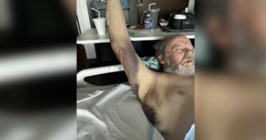 'How could you do that to an elderly person': 73-year-old man with dementia attacked by hospital worker at HCA Orange Park, family demands answers