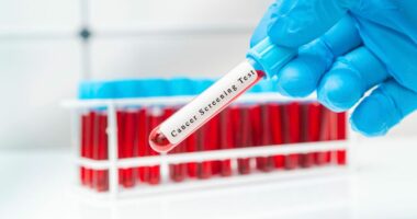 I'm a doctor and here are 6 symptoms of colon cancer you should never ignore