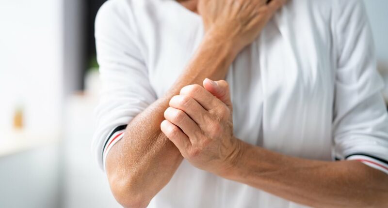 My arms are always itchy and it's driving me crazy. What could be the cause? It could be an unsettling infection says DR PHILIPPA KAYE - but there is a cure