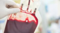 New study reveals people with second-most common blood type are at the highest risk of developing deadly liver disease