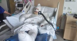 Falcon mum-of-two Penny Travers (pictured) suffered burns to 25 per cent of her body in the alleged attack