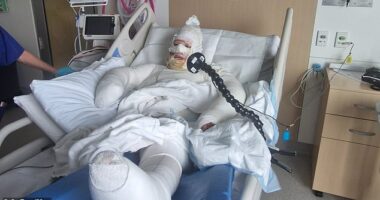 Falcon mum-of-two Penny Travers (pictured) suffered burns to 25 per cent of her body in the alleged attack