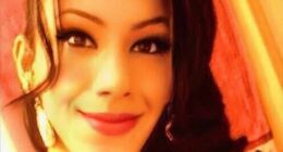 Stunning influencer left 'deformed' after botched surgery