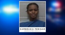 Woman accused of biting off another woman's thumb during altercation