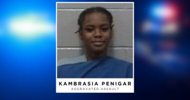 Woman accused of biting off another woman's thumb during altercation