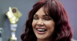 'Lithuania facelift left me with lopsided mouth and hearing loss'