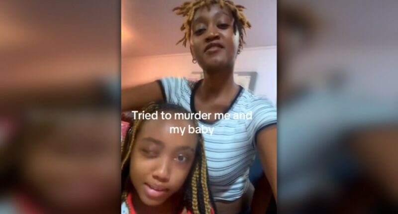 Beaten, tortured and traumatized, 12-year-old Bronx girl makes heroic recovery: Mom