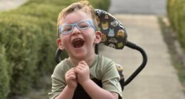 Doctors ignored my worries and blamed my baby's problems on his weight... I pushed for answers until he was diagnosed with a brain abnormality