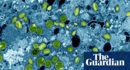 England health officials identify newly evolved strain of mpox
