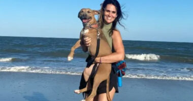 Georgia Woman Suffers 3rd Degree Burns in Savannah Chemical Attack