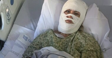 Georgia woman hospitalized after attacker hurls corrosive chemical during evening walk