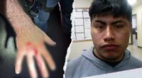 Illegal immigrant bites ICE officer in 'gross attack' while resisting arrest: DHS