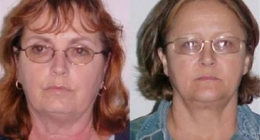 Inside the Shocking Murder Plot 2 Missouri Grandmothers Hatched Against a Husband